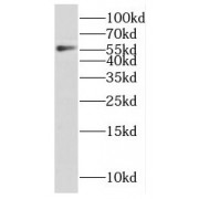 WB analysis of Tunicamycin treated HepG2 cells, using F9 antibody (1/600 dilution).