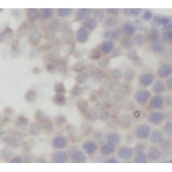 Fatty Acid Amide Hydrolase (FAAH) Antibody