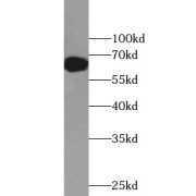 WB analysis of mouse liver tissue, using FAAH antibody (1/1000 dilution).