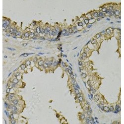 Fatty Acid Binding Protein 1, Liver (FABP1) Antibody