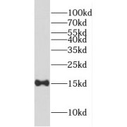 WB analysis of human heart tissue, using FABP4 antibody (1/300 dilution).
