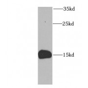 WB analysis of human brain tissue, using FABP5 antibody (1/1000 dilution).