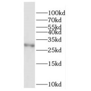 WB analysis of Jurkat cells, using F12 antibody (1/500 dilution).