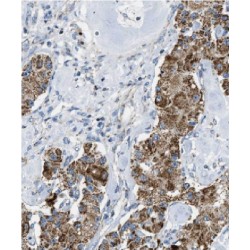 Fatty Acid Desaturase 1 (FADS1) Antibody