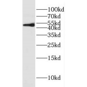 WB analysis of mouse brain tissue, using FADS1 antibody (1/1000 dilution).