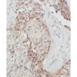 PTK2 Protein Tyrosine Kinase 2 (FAK) Antibody