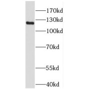 WB analysis of MCF7 cells, using FAK antibody (1/2000 dilution).