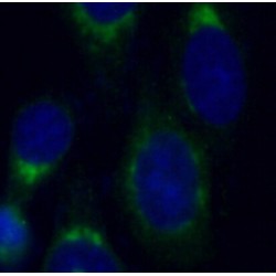 Protein FAM3C (FAM3C) Antibody