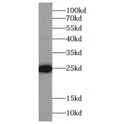 WB analysis of fetal human brain tissue, using FAM3C antibody (1/1000 dilution).