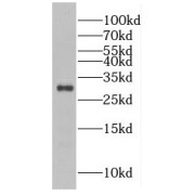 WB analysis of mouse colon tissue, using FAM3D antibody (1/6000 dilution).