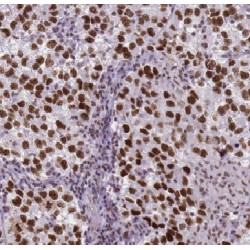 Family With Sequence Similarity 48 Member A (FAM48A) Antibody