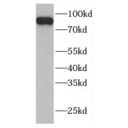 WB analysis of PC-3 cells, using FAM48A antibody (1/300 dilution).