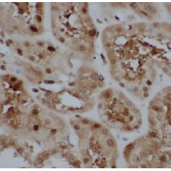 Family With Sequence Similarity 49 Member B (FAM49B) Antibody