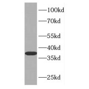 WB analysis of mouse brain tissue, using FAM49B antibody (1/500 dilution).