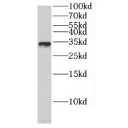 WB analysis of HeLa cells, using CBY1-Interacting BAR Domain-Containing Protein 1 (CIBAR1) antibody (1/600 dilution).