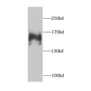 WB analysis of HeLa cells, using FANCA antibody (1/1000 dilution).