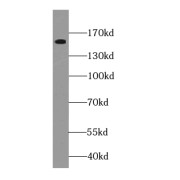 WB analysis of HEK-293 cells, using FANCA-Specific antibody (1/500 dilution).