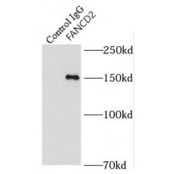 Fanconi Anemia Complementation Group D2 (FANCD2) Antibody