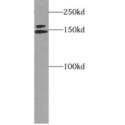 WB analysis of HL-60 cells, using Fanconi Anemia Group D2 Protein (FANCD2) antibody (1/500 dilution).