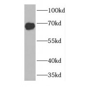 WB analysis of Jurkat cells, using Fanconi Anemia Group G Protein (FANCG) antibody (1/100 dilution).
