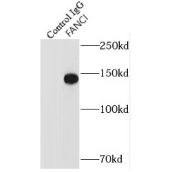 Fanconi Anemia Group I Protein (FANCI) Antibody