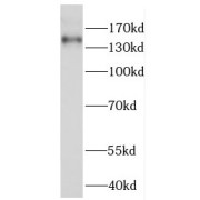 WB analysis of HepG2 cells, using Fanconi Anemia Group I Protein (FANCI) antibody (1/500 dilution).