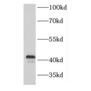 WB analysis of HEK-293 cells, using E3 Ubiquitin-Protein Ligase FANCL antibody (1/300 dilution).