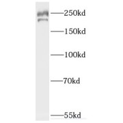 WB analysis of HeLa cells, using Fanconi Anemia Group M Protein (FANCM) antibody (1/300 dilution).