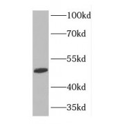 WB analysis of HeLa cells, using FARS2 antibody (1/500 dilution).