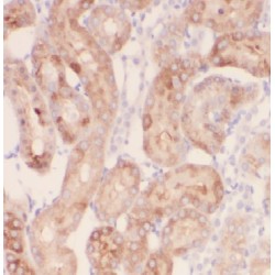 Phenylalanine-tRNA Synthetase, Alpha Subunit (FARSA) Antibody