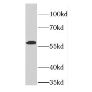 WB analysis of HepG2 cells, using FARSA antibody (1/500 dilution).