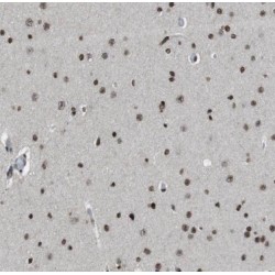 Phenylalanine-tRNA Synthetase, Beta Subunit (FARSB) Antibody