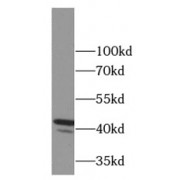 WB analysis of HeLa cells, using FAS/CD95 antibody (1/4000 dilution).