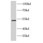 WB analysis of SH-SY5Y cells, using Fascin antibody (1/600 dilution).