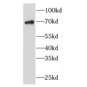 WB analysis of mouse brain tissue, using FBF1 antibody (1/400 dilution).