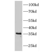 WB analysis of mouse skeletal muscle tissue, using FBP2 antibody (1/600 dilution).