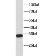 WB analysis of MDA-MB-453s cells, using FBXL15 antibody (1/300 dilution).