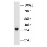 WB analysis of SH-SY5Y cells, using FBXO2 antibody (1/300 dilution).