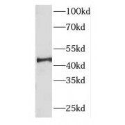 WB analysis of HeLa cells, using FBXO22 antibody (1/500 dilution).