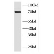 WB analysis of HEK-293 cells, using FBXO43 antibody (1/300 dilution).