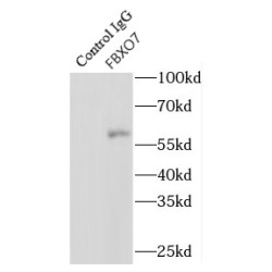 F-Box Protein 7 (FBXO7) Antibody