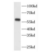 WB analysis of HeLa cells, using FBXO7 antibody (1/1000 dilution).