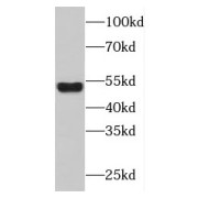 WB analysis of human liver tissue, using FBXO9 antibody (1/300 dilution).