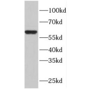 WB analysis of SGC-7901 cells, using FBXW11 antibody (1/2000 dilution).