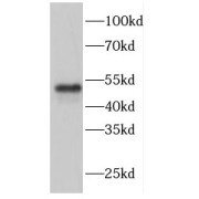 WB analysis of mouse lung tissue, using FBXW4 antibody (1/300 dilution).