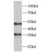 WB analysis of human placenta tissue, using FCN3 antibody (1/500 dilution).