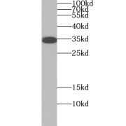 WB analysis of human placenta tissue, using FCGRT-Specific antibody (1/300 dilution).