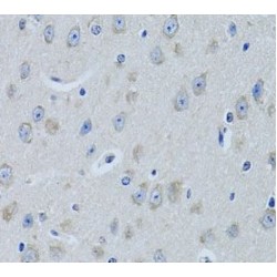 Farnesyl Diphosphate Farnesyltransferase 1 (FDFT1) Antibody