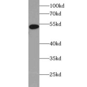 WB analysis of human adrenal gland tissue, using FDXR antibody (1/1200 dilution).