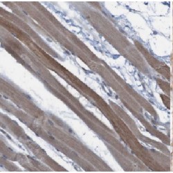 Protein Fem-1 Homolog A (FEM1A) Antibody